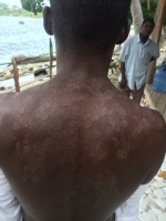 There are many people with skin problems.